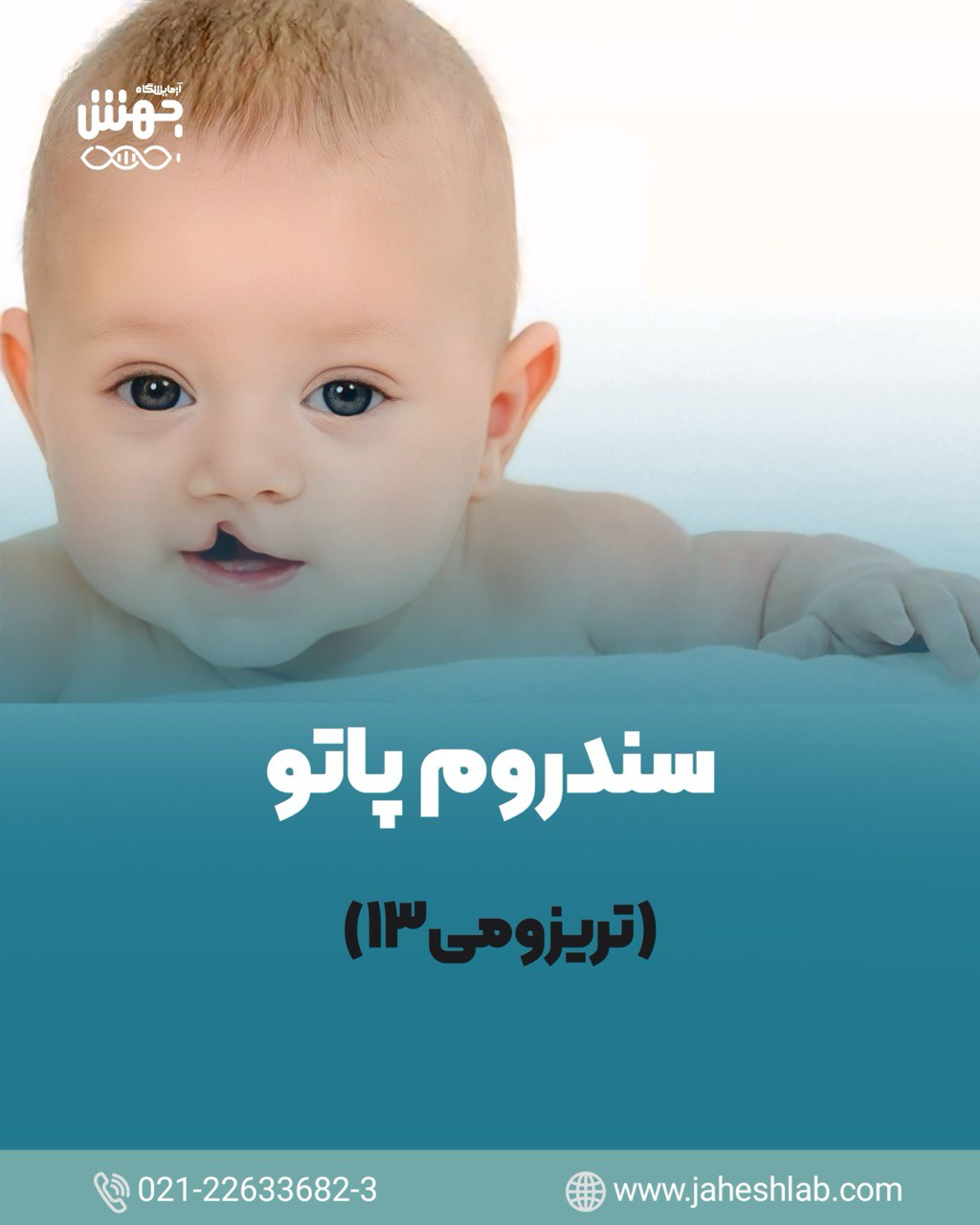 ژنتیک سندروم پاتو: علل، علائم و راه‌های مدیریت